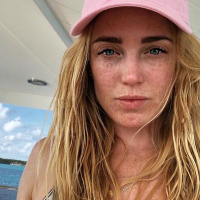 as sardas e seu abdômen - Fuckmeat Caity Lotz