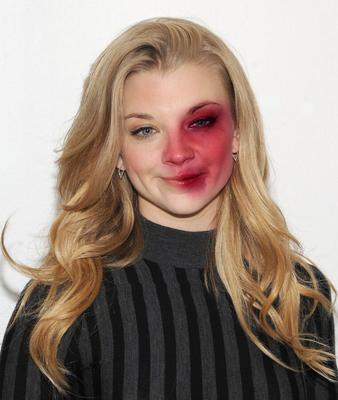 Natalie Dormer Moretones Falsos por KK