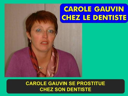 JE FAIS LA PUTE CHEZ MON DENTISTE