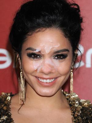 Vanessa Hudgens Gesichtsbehandlungen