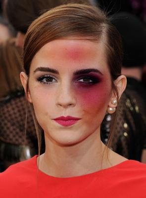 Emma Watson Bruise Fakes By KK