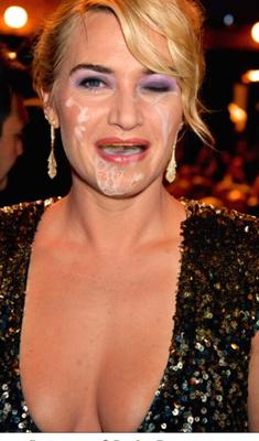 Kate Winslet Tratamentos Faciais