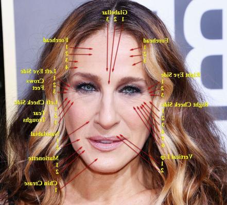 SARAH JESSICA PARKER - Wrinkles